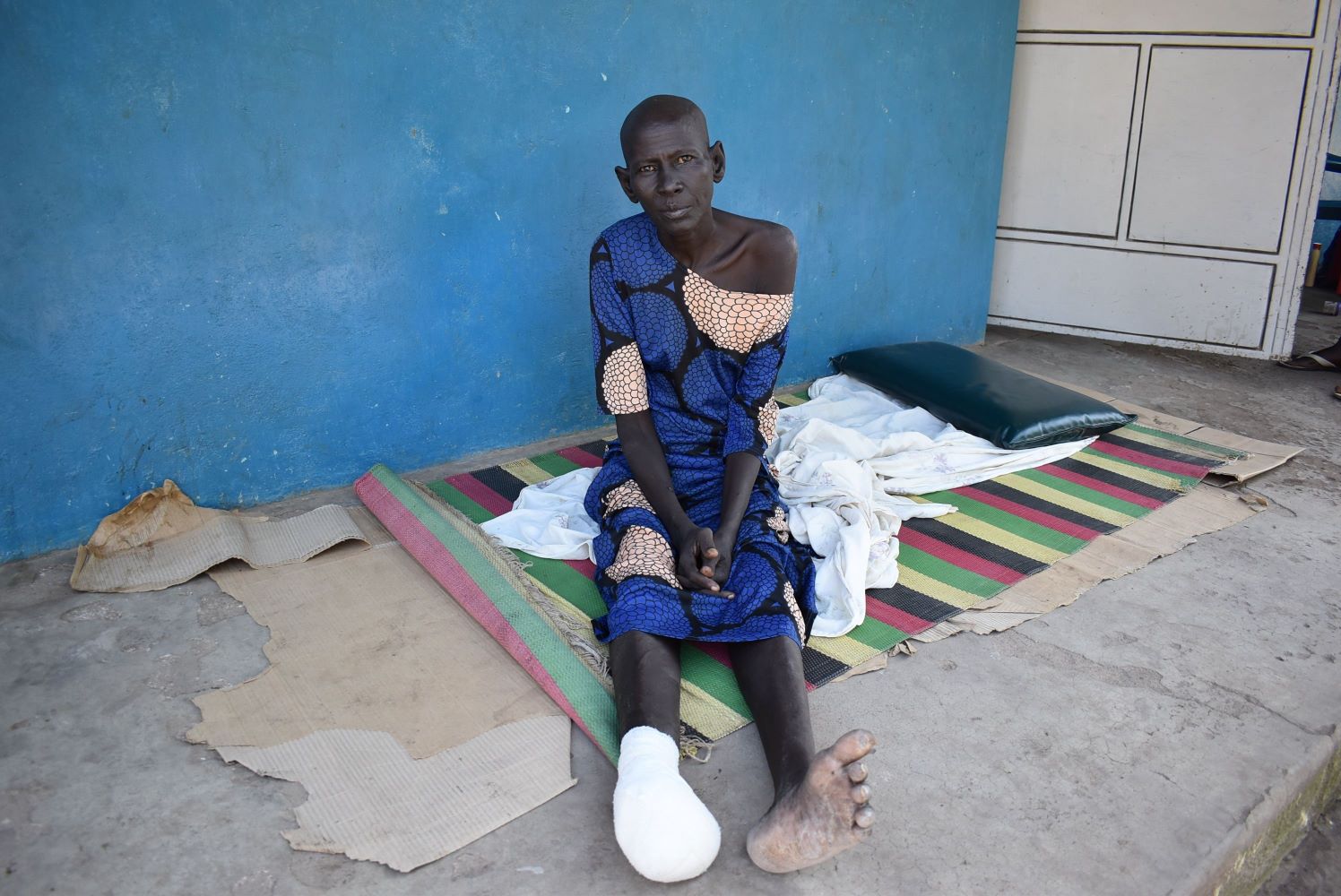 An African woman sits on a mat at a Maupordit hospital Her amputated foot is bandaged.